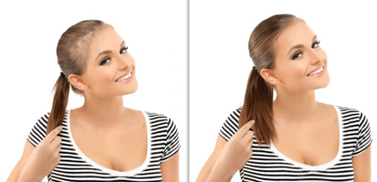 Thinning Hair from Hypothyroidism? Here’s How Wigs Can Help