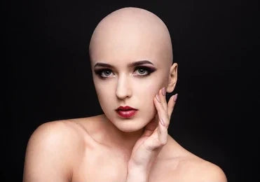 Lichen Planopilaris and Hair Loss: Understanding the Condition and How Wigs Can Help Restore Confidence