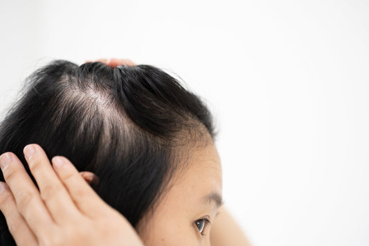 Understanding Cicatricial Alopecia: Hair Loss and How Wigs Can Help