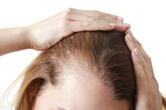 From Hair Loss to Hair Confidence: A Wig-Friendly Guide to Androgenetic Alopecia