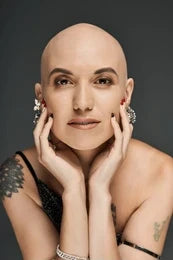 When Your Hair Tells a Story: Understanding Hypothyroidism and Hair Loss